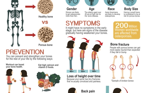 Osteoporosis y osteopenia